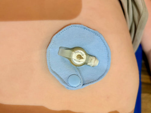 Pads de Gastrostomie personnalisé - Fait à la main au Québec